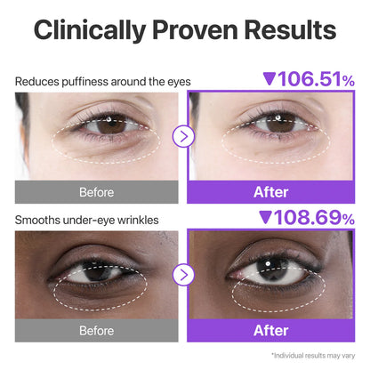 No.9+ NAD+ Collagen Under Eye Patches