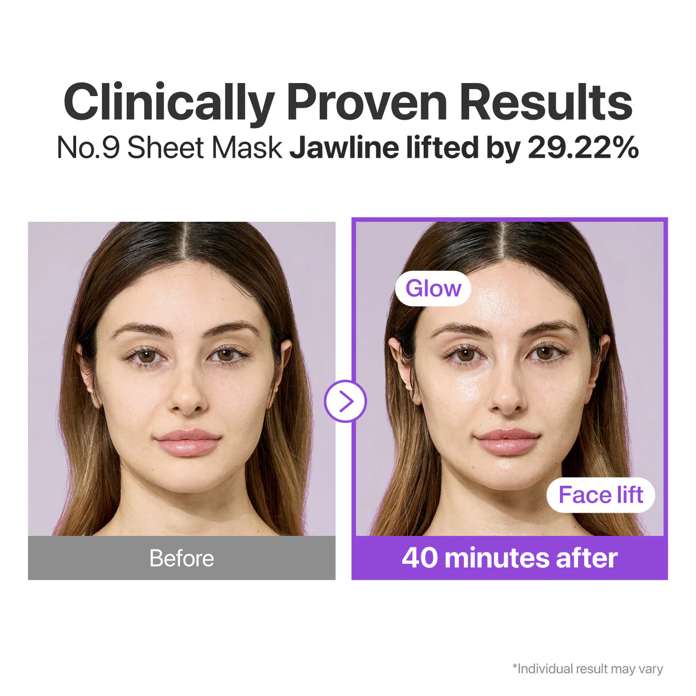 NAD+ BIO Lifting-sil Full Face Mask, single