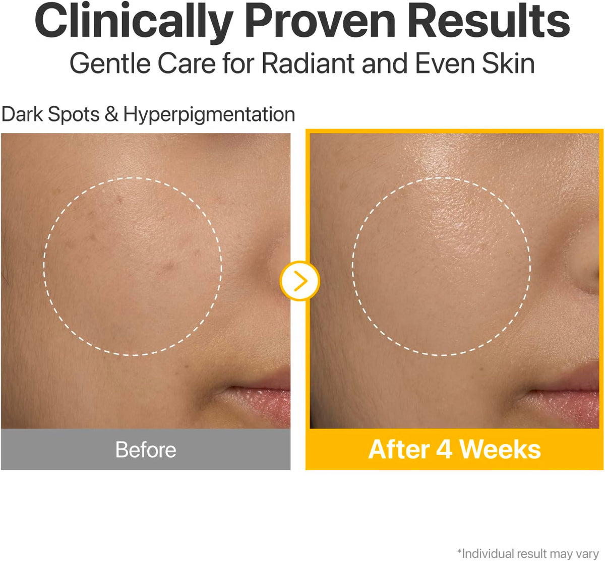 No. 5+ Glutathione Vitamin Concentrated Serum